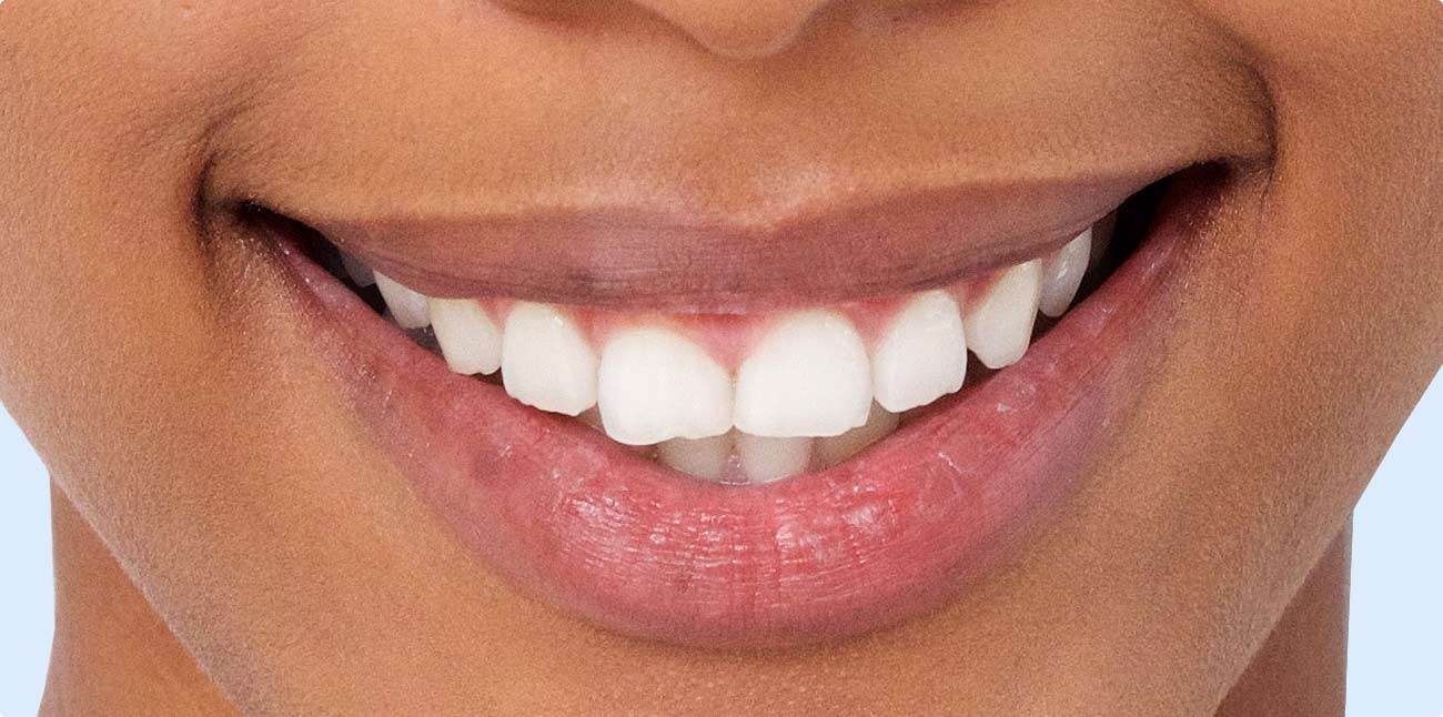 after treatment