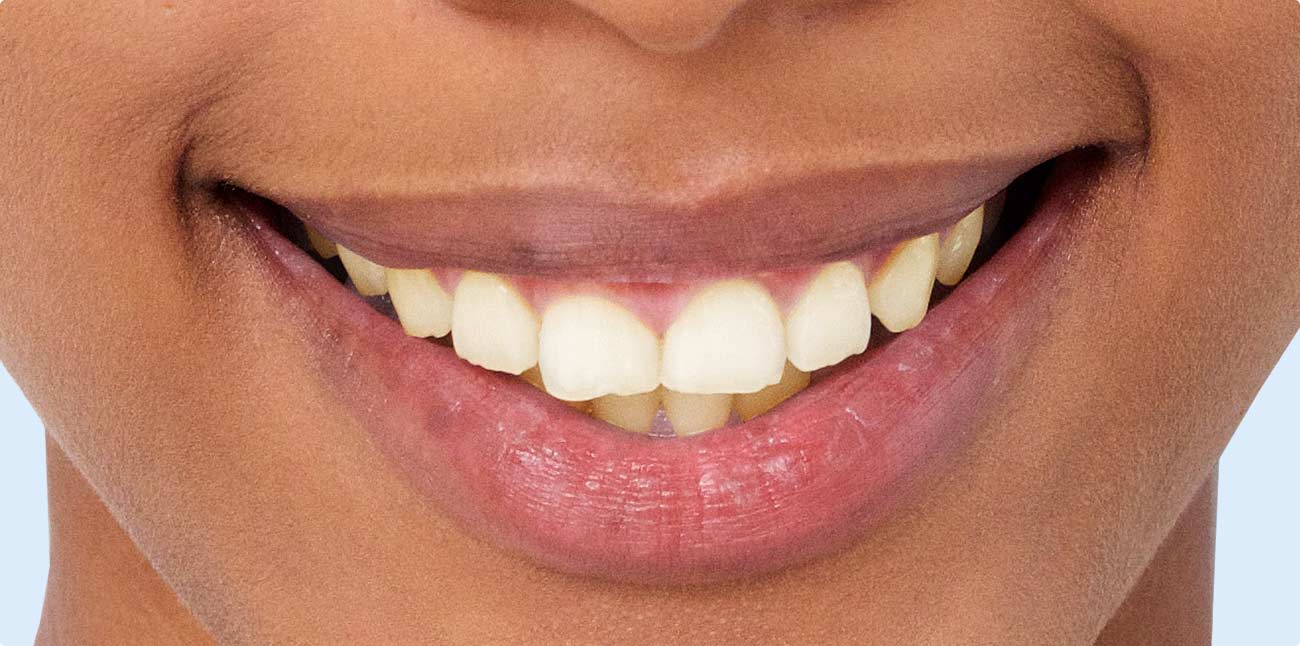 before treatment